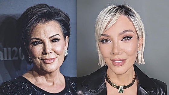 ¿Qué es el Deep Plane? La cirugía que todos quieren... pero solo pueden pagar las Kardashian