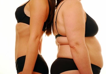 Los cuatro tipos de obesidad y las claves para tratarla