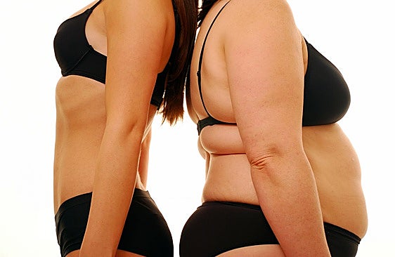Los cuatro tipos de obesidad y las claves para tratarla