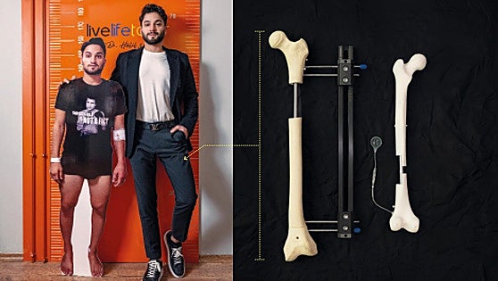 Los hombres que van a una clínica a que les rompan las piernas