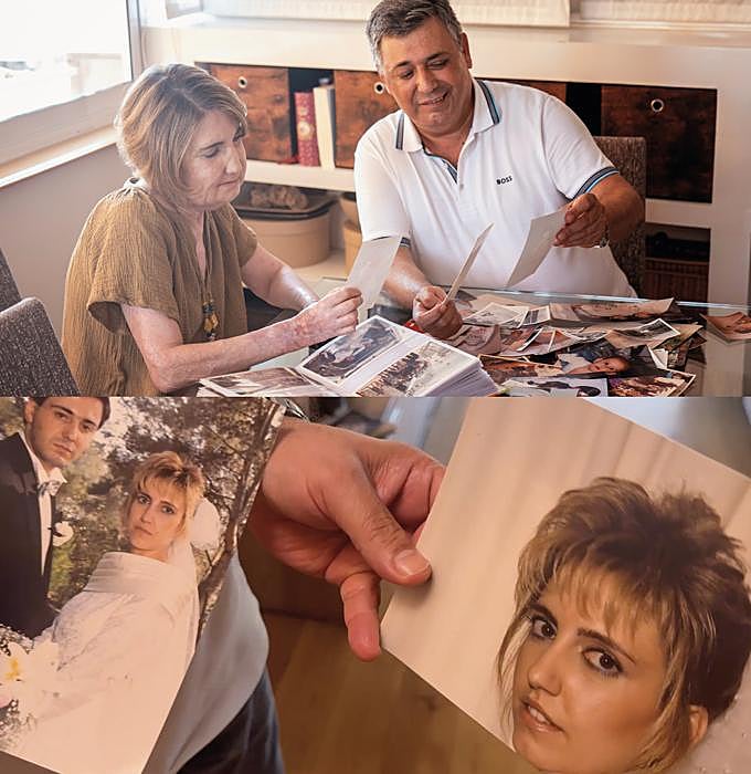 Carmen y Carlos, su marido, revisan álbumes familiares con fotos anteriores a la operación.