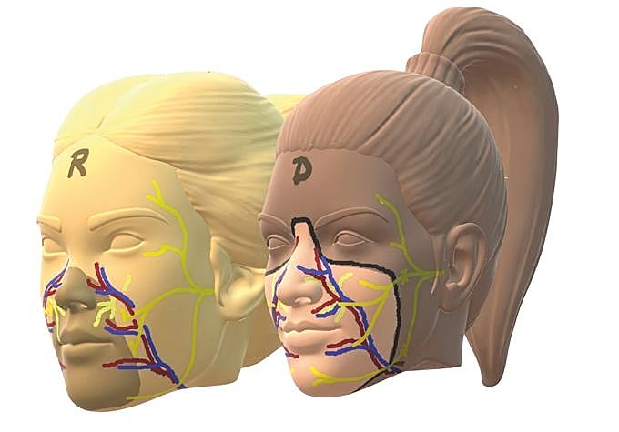 Para realizar el trasplante se extrae el tejido facial del donante: piel, músculos, nervios, hueso e incluso piezas dentales. Los dientes superiores laterales de Carmen, de hecho, son de la donante. En paralelo, se prepara al receptor, extirpando el tejido dañado y exponiendo los vasos sanguíneos y nervios que se conectarán al nuevo rostro. Tras restablecer el flujo sanguíneo, se realiza la unión de los nervios faciales.