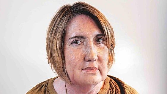 La vida con el rostro de otra: «No soy yo, pero fea no me veo»