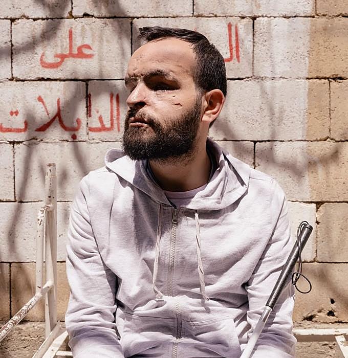 Ahmed Alafi, un ingeniero de Hezbolá, quedó ciego tras el ataque con 'buscas' lanzado en 2024 por el Mossad