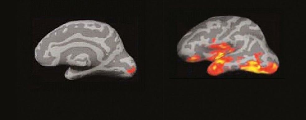 (A la izquierda) 1. Cuando leemos, cada palabra que ve nuestra retina produce un eco en la corteza cerebral. La primera señal eléctrica se aprecia en el polo occipital. (A la derecha) 2. La actividad se extiende a la región temporal izquierda, donde está el buzón del lenguaje, que aísla la forma visual de la palabra y la reconoce.