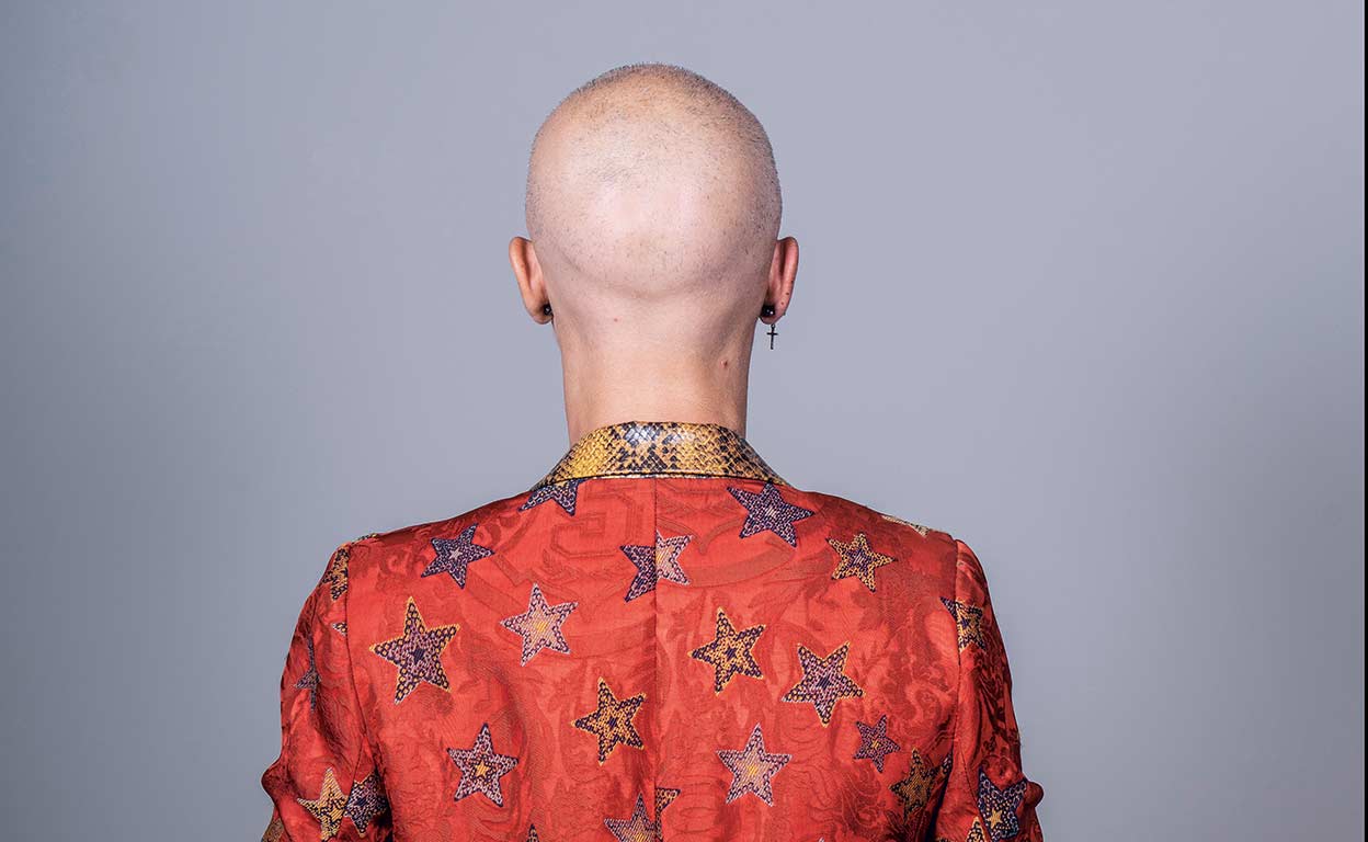 El misterioso aumento de la alopecia femenina