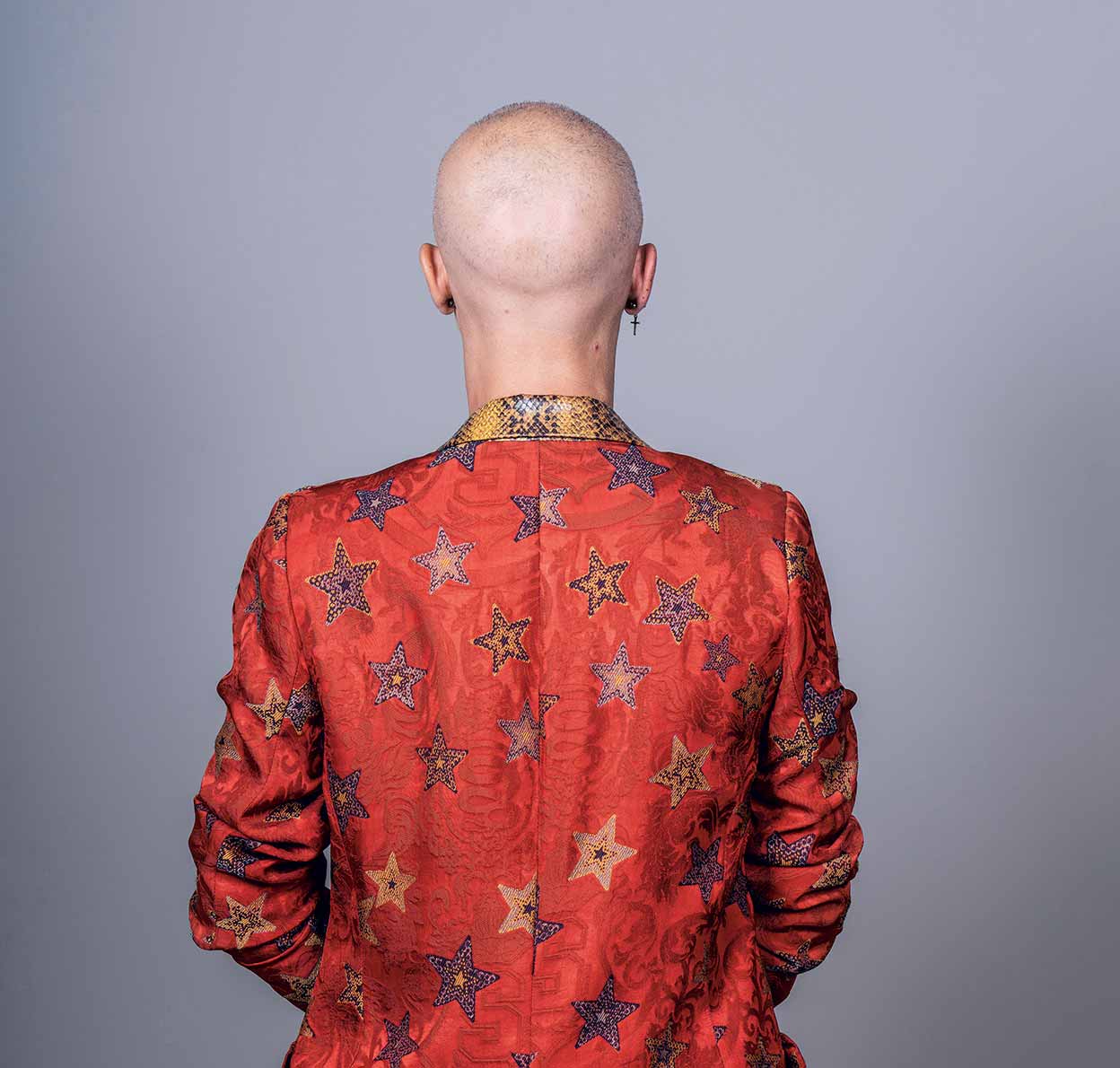 El misterioso aumento de la alopecia femenina