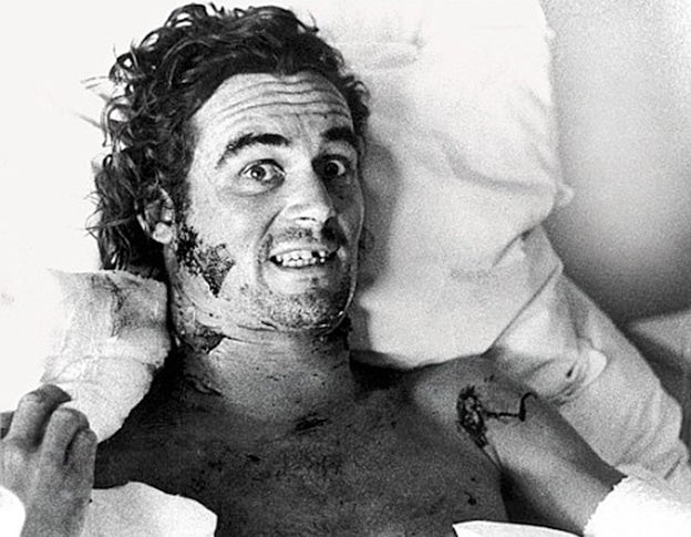 Fitzjohn en el hospital tras ser atacado en 1974 por un león que había sido intoxicado. El animal le dejó un agujero en el cuello y se llevó un trozo de oreja, pero milagrosamente no le cortó la yugular. El ataque no lo desanimó; al contrario.