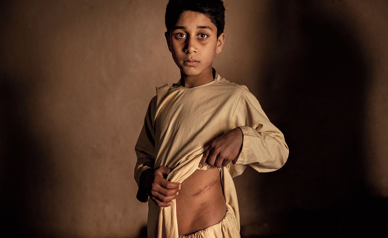 La tragedia de vender un riñón para no morir de hambre