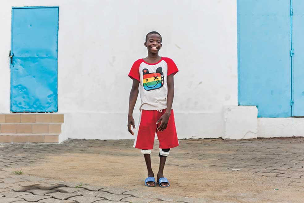 El pequeño Ulrich después de someterse a varias operaciones en el Africa Mercy, buque hospital de la ONG Mercy Ships, en el que trabajan más de 400 voluntarios.