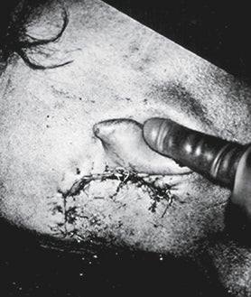 Imagen secundaria 2 - Otro asesinato en directo. Noguchi había realizado la autopsia de Marilyn seis años antes y esta vez tenía sobre la mesa el cuerpo de su supuesto amante, Robert F. Kennedy. En las fotos, su última aparición (1) antes de que le disparasen (2). El impacto de la bala tras la oreja (3) fue letal: el cabello se lo habían rasurado en el preoperatorio para intentar salvarlo.