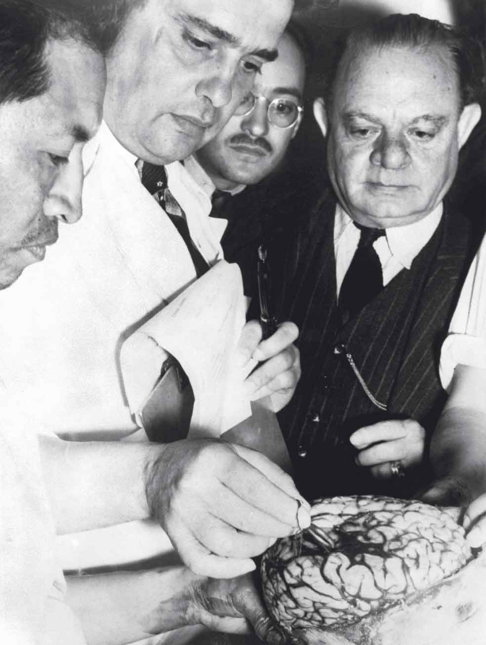 Un estudio del cerebro de Trotsky realizado por el profesor mexicano Luis Benítez y Soto reveló que sus neuronas tenían un tamaño excepcional, por lo que podría ser considerado un superdotado.