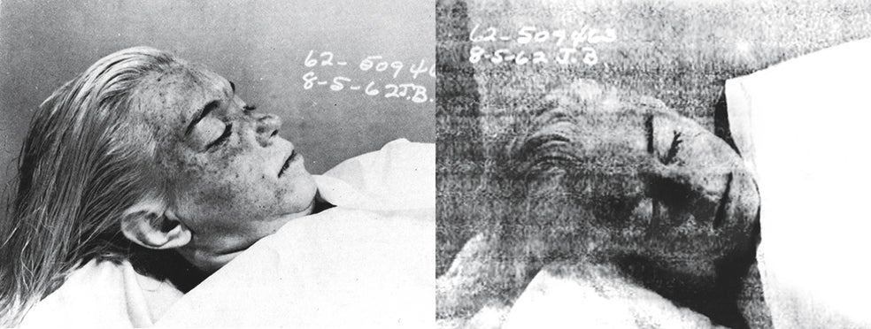 «El cadáver estaba cubierto por una sábana blanca. Lo destapé lentamente y me detuve. Me costó unos instantes hacerme a la idea de que estaba contemplando el rostro de la verdadera Marilyn», cuenta Noguchi.