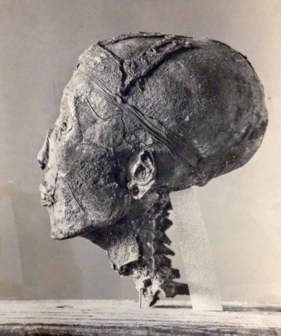 Cuando Howard Carter quiso quitar la máscara mortuoria se encontró con que estaba adherida a la cabeza, prueba de que la momificación había sido precipitada.