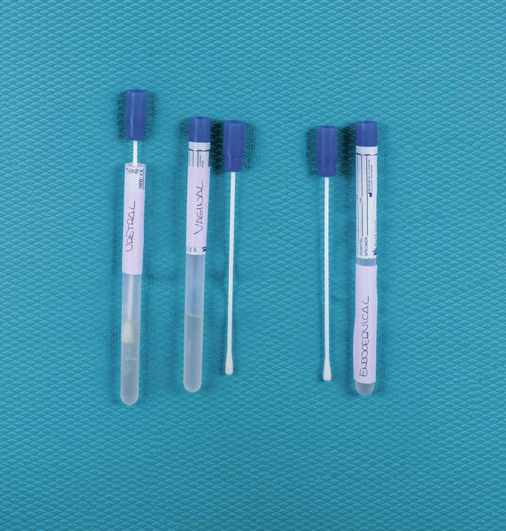 Imagen - PRUEBAS EN LA VAGINALos bastoncillos también se usan para recoger muestras vaginales, uretrales y endocervicales y también material orgánico e inorgánico del cuerpo de la víctima.