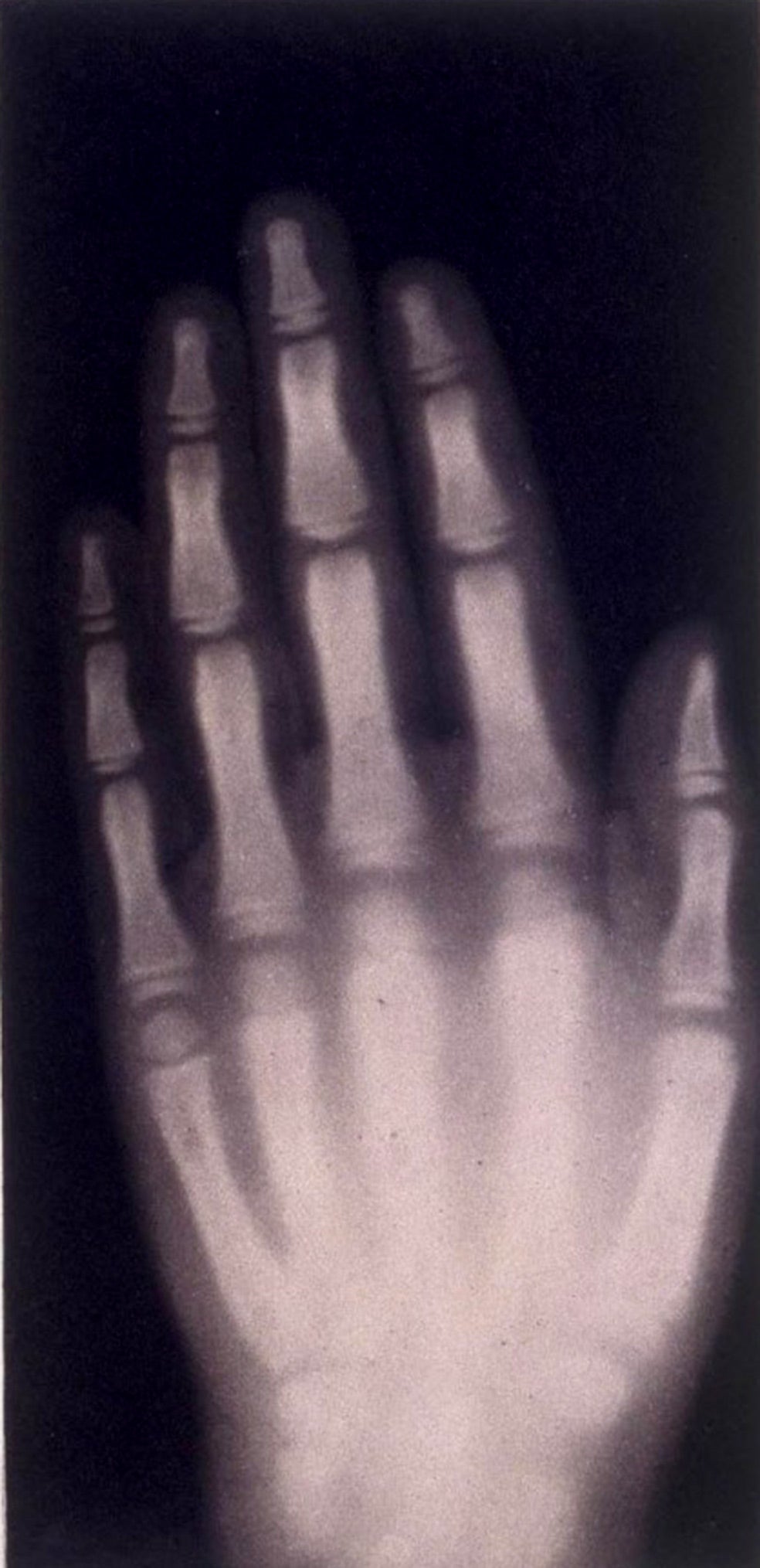 Su mano recibió la primera radiografía. Por el descubrimiento de estas radiaciones recibió el premio Nobel de Física en 1901.