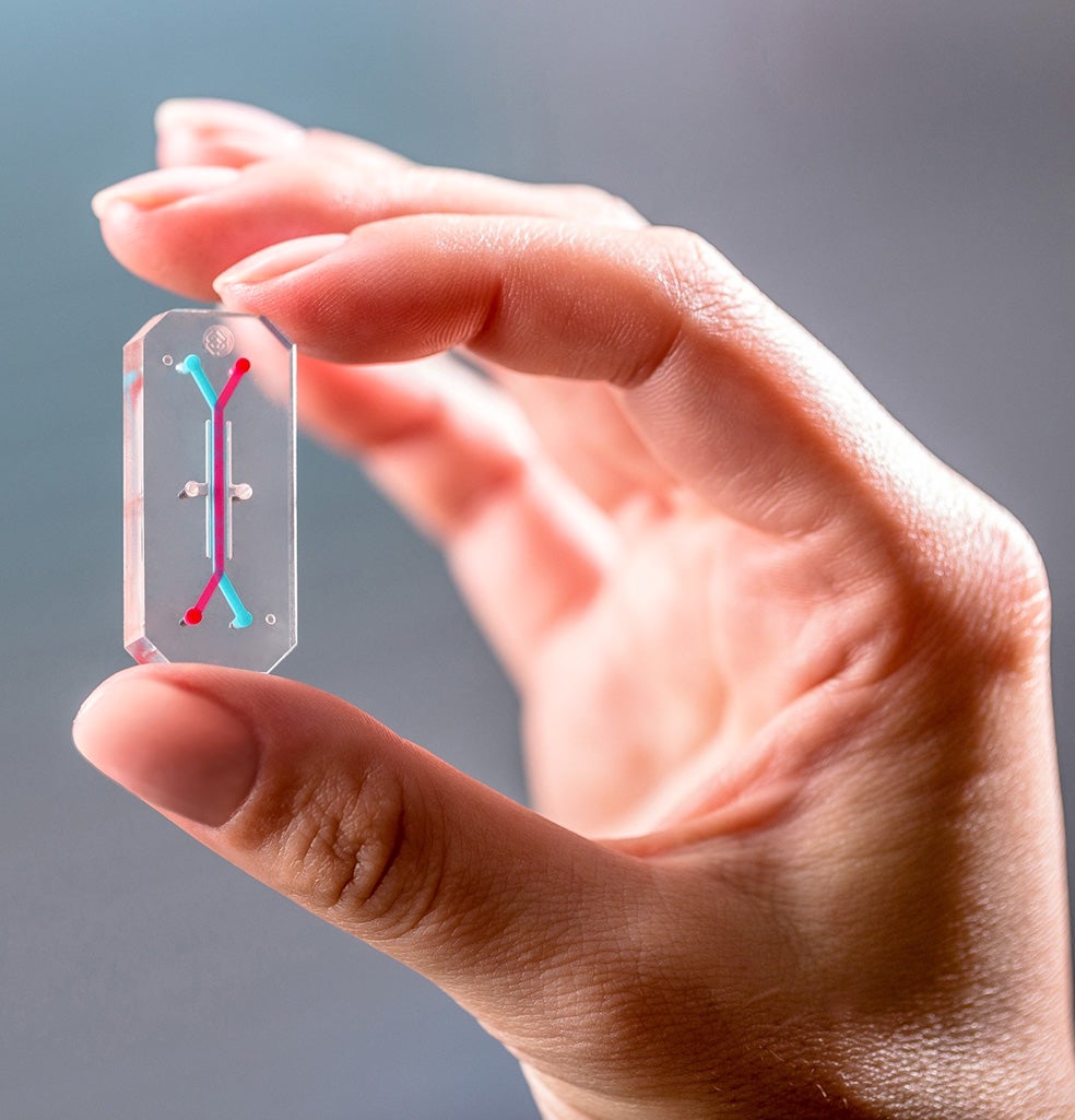 Los órganos en chips son dispositivos fabricados a escalas micrométricas que tienen como objetivo replicar funciones de un órgano vivo en una estructura tridimensional. El primero creado en 2010 fue un modelo de pulmón. El dispositivo es capaz de replicar funciones básicas como el intercambio de oxígeno y dióxido de carbono. Pero hay de hígado (en la foto, células de hígado cultivadas en fluido), piel, cerebro...