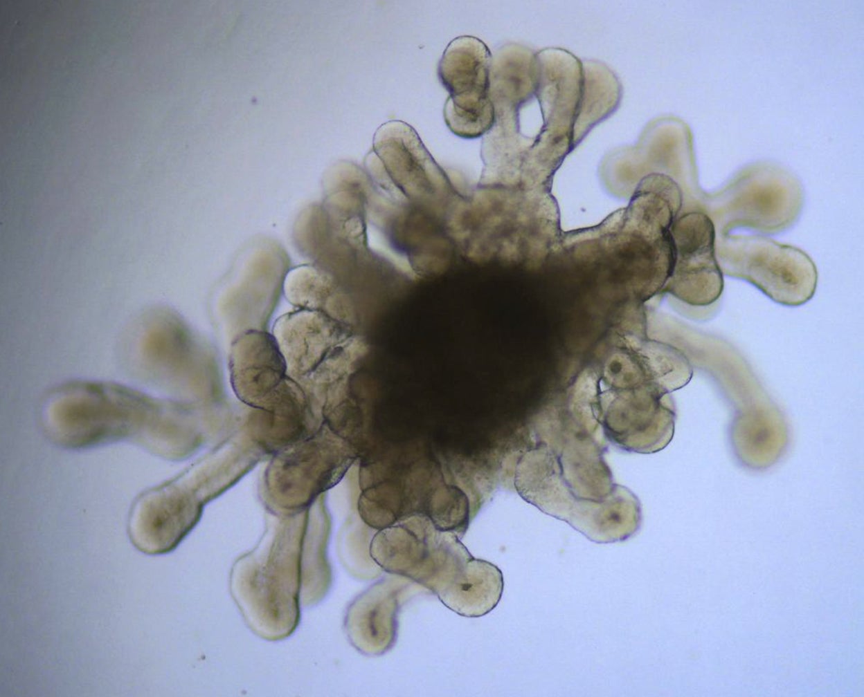 Los organoides son una versión miniaturizada de un órgano. Se crean a partir de pequeñas muestras de tejido cultivadas in vitro. Alimentando las células con determinados nutrientes e instrucciones genéticas, los científicos pueden inducirlas a autoorganizarse en estructuras que se asemejan a los órganos.