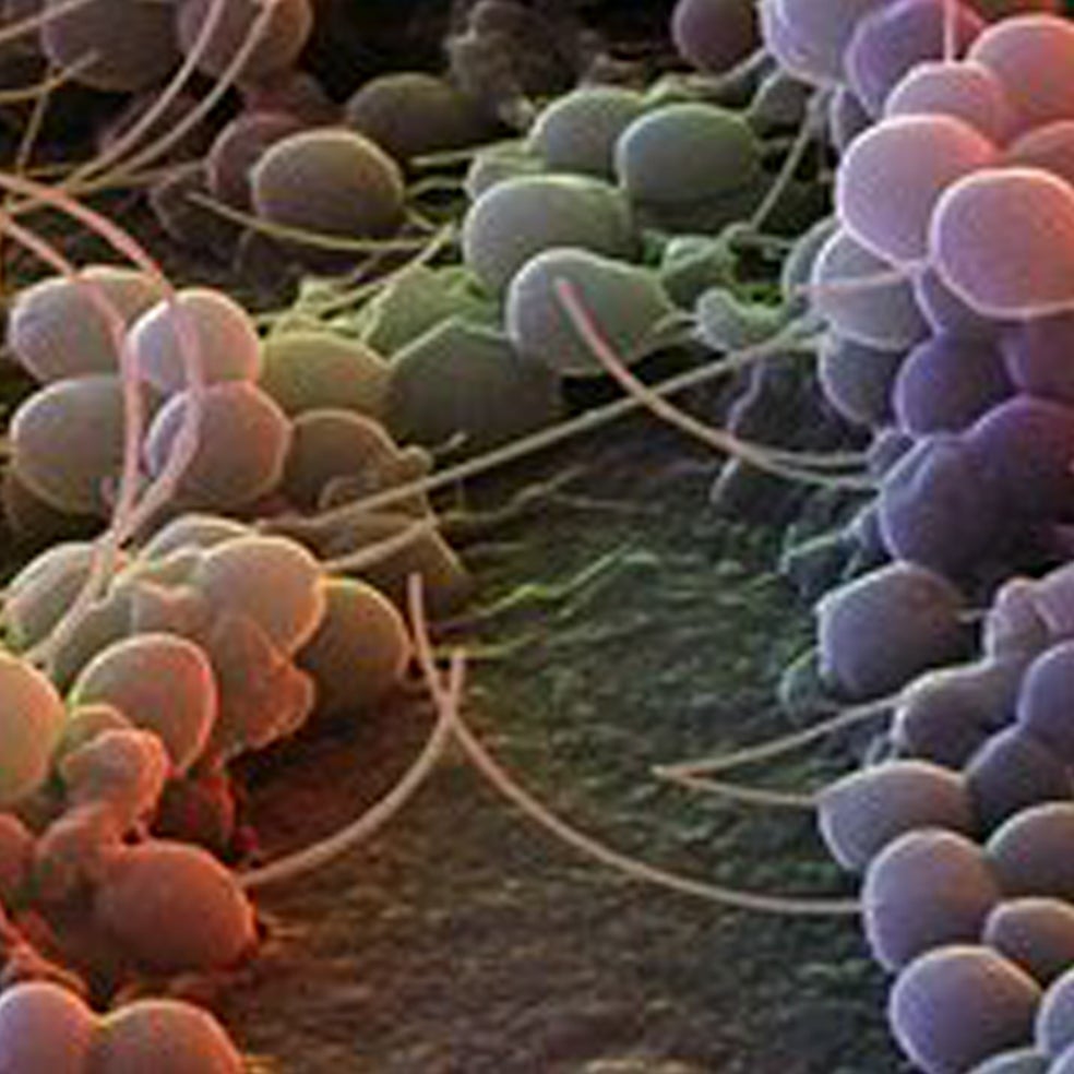 Imagen - 10. Axilas: La grasa es su alimento