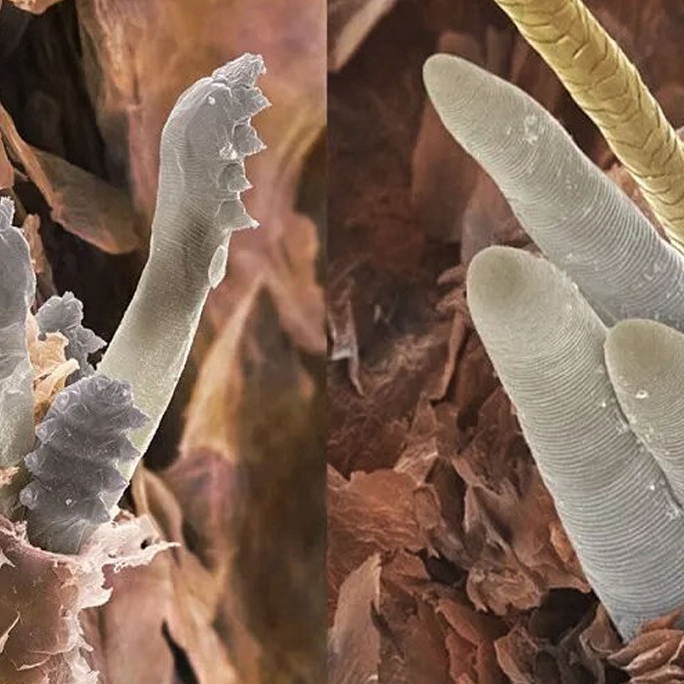 Imagen - 2. Cara: de frente con los ácaros