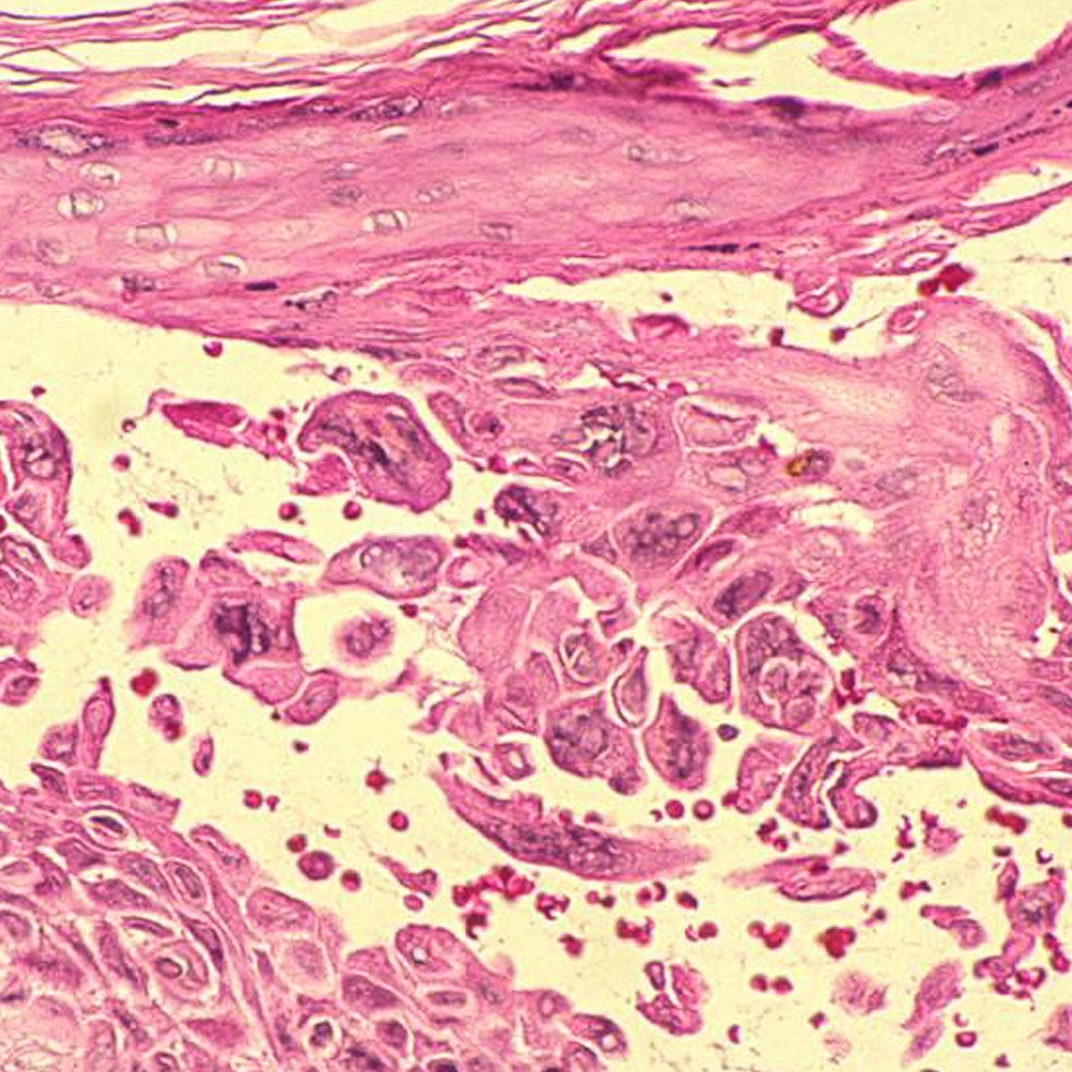 Imagen - 4. Columna vertebral: Si el virus entra, permanece