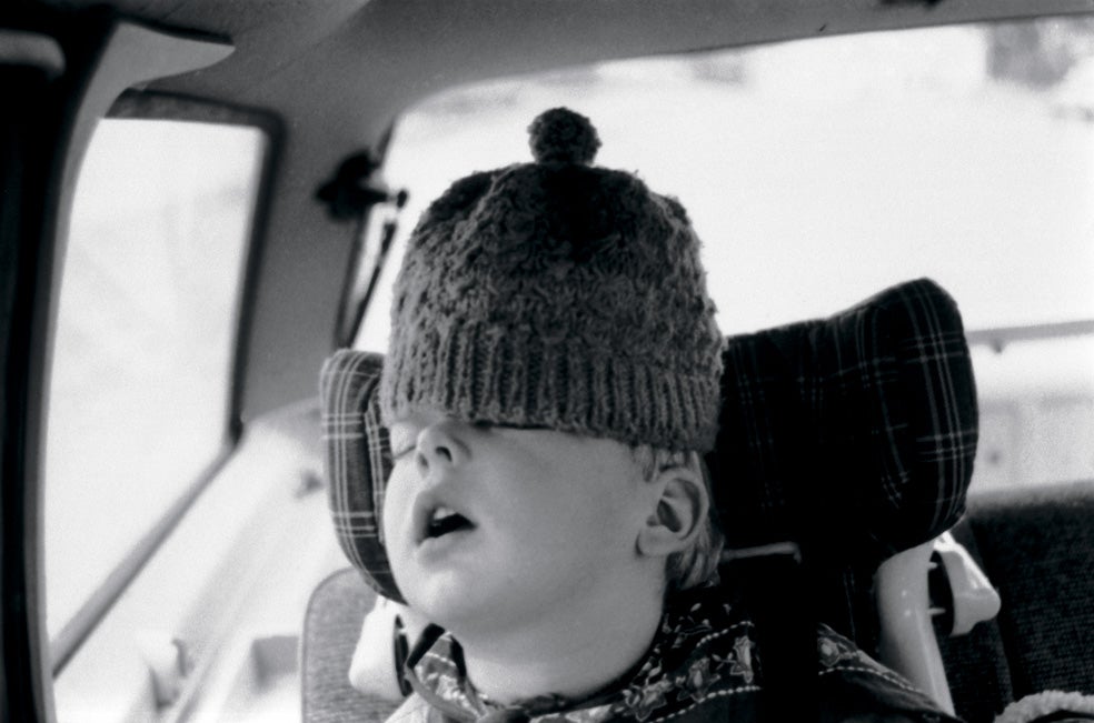 La roncopatía en un niño puede tener repercusiones en su desarrollo. Según el doctor Jordi Coromina, autor de El niño roncador, «el motivo del ronquido siempre es un excesivo tamaño de las amígdalas y de las vegetaciones. Eso hace que el niño respire por la boca, lo cual a la larga se traduce en alteraciones en la forma de los dientes, lo que llamamos 'mala oclusión'. Además, para ellos el sueño nunca llega a ser profundo, no descansan y, al contrario que el adulto roncador, tienen tres veces más posibilidades de ser hiperactivos». Además, el niño que ronca genera menos hormona de crecimiento y puede padecer incontinencia urinaria nocturna.