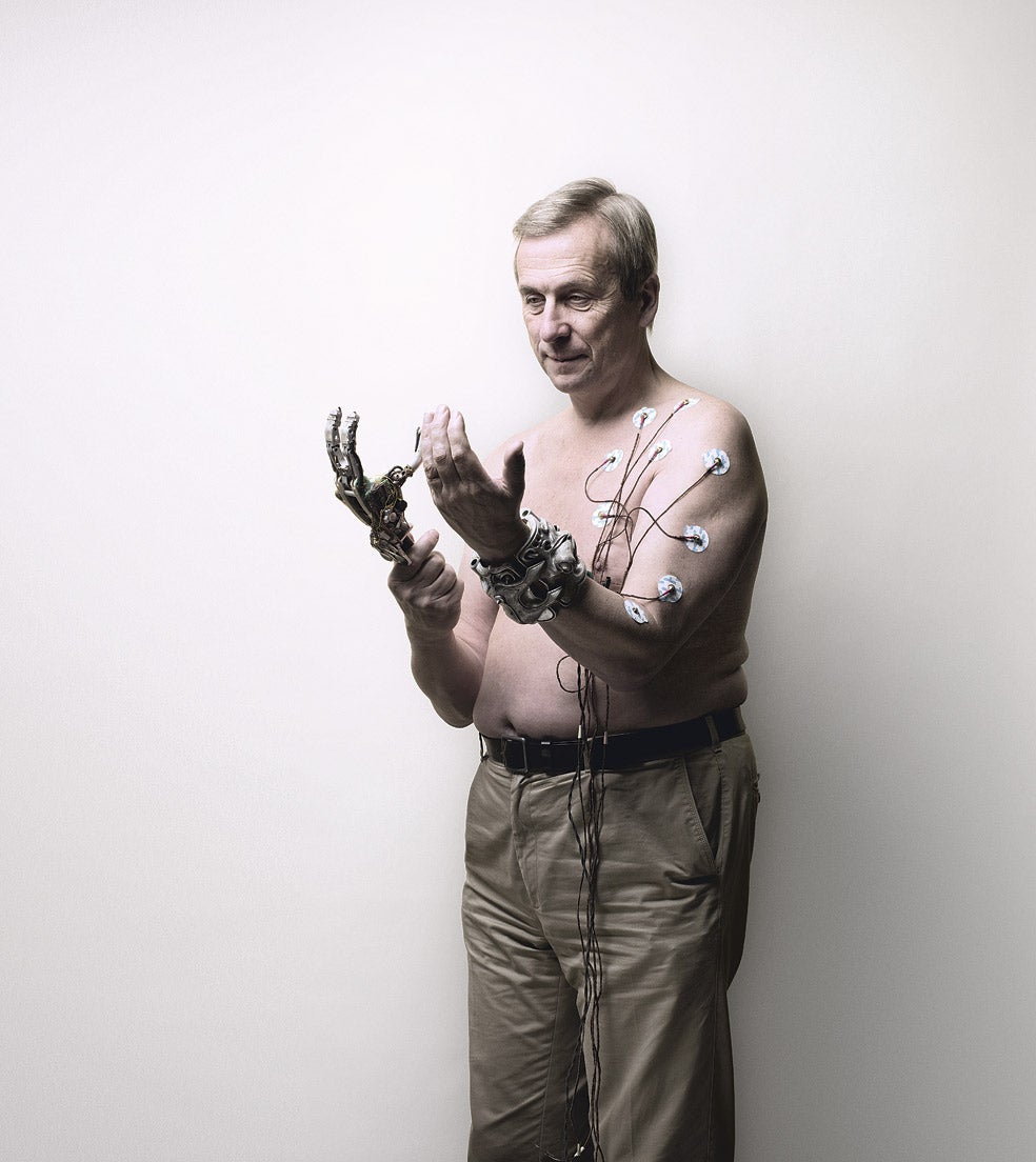 Lo llaman doctor cyborg y no es extraño. Se ha insertado microchips en el cuerpo para experimentar con el concepto de transhumanismo.