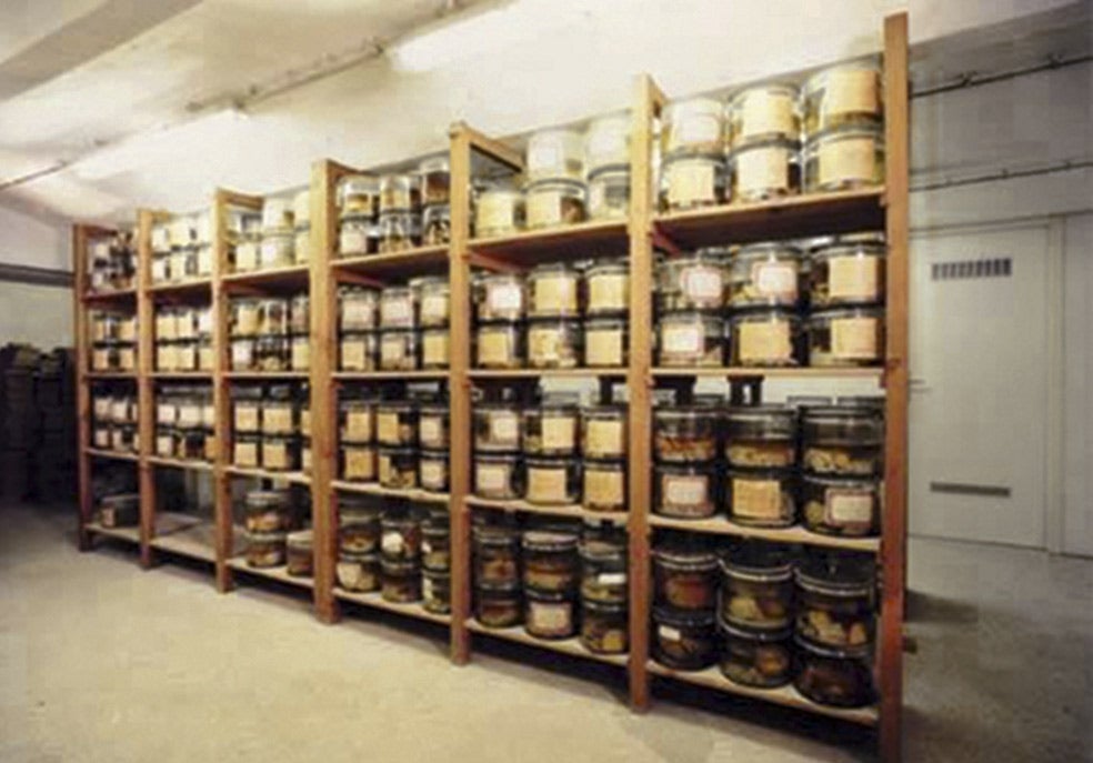 En el archivo del Instituto Max Planck en Múnich han hallado frascos con más de 50 muestras en formol con la edad, la causa y la fecha de la muerte de los pacientes.
