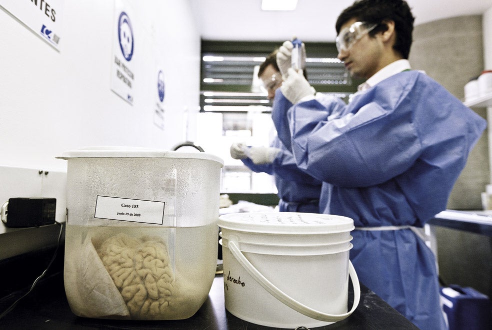 El laboratorio de neurociencia de la Universidad de Antioquia conserva la colección más grande del mundo de cerebros con alzhéimer prematuro. El peso medio de estos órganos suele ser la mitad de uno normal.
