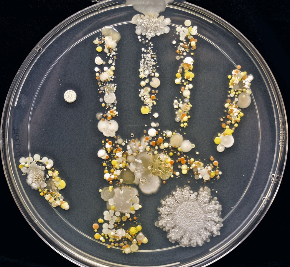 Imagen real de las bacterias presentes en la mano sin lavar de un niño, registrada en una placa de Petri por la microbióloga californiana Tasha Sturm.