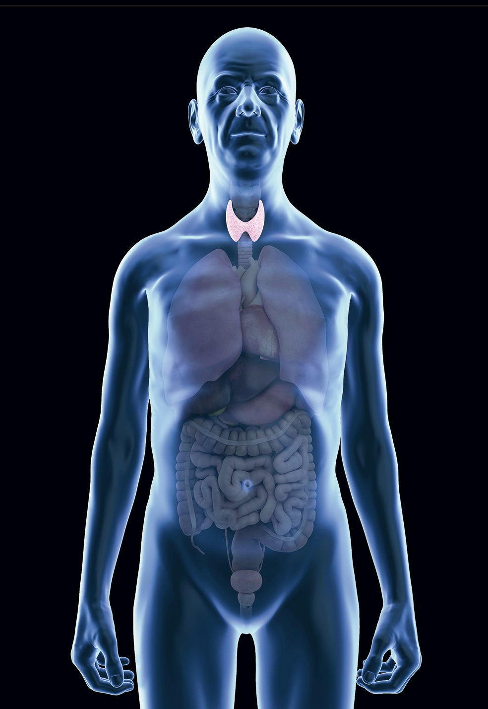 Los síntomas son llamativos; por eso, el paciente acude antes al médico: metabolismo acelerado, pérdida de peso, taquicardias, aumento de la sudoración, temblores, cansancio, bocio (a veces), piel húmeda y ojos saltones.