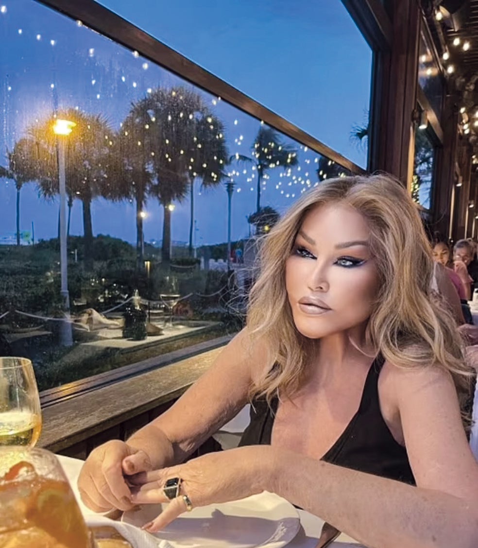 Las drag queens la adoran e imitan; se dice que el personaje de Jennifer Coolidge de la serie White Lotus está basado en parte en ella... El documental ya terminado, aunque sin fecha de estreno, bien podría ser un éxito y un revulsivo para su vida (y su cuenta corriente) teniendo en cuenta el carisma de Wildenstein para reinventarse.