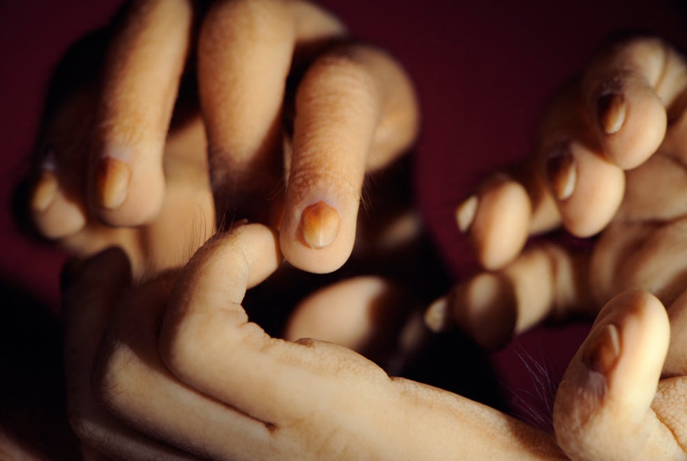 Con siete semanas, el embrión de un lémur apenas se distingue de uno humano. A partir de ahí comienzan a diferenciarse. Aunque las manos de este primate a punto de nacer, tras 140 días de gestación, tienen aspecto humano.