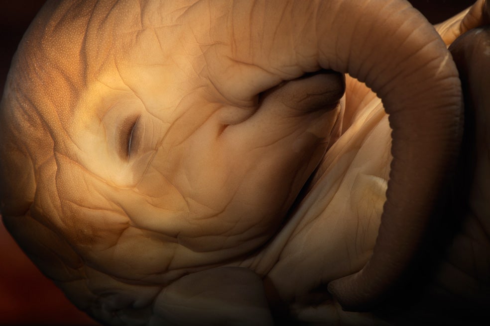 Tras cuatro meses en el vientre materno, este elefante africano mide 25 centímetros. La elefanta lleva dentro a su retoño algo más de 20 meses. Al nacer, el bebé mide unos 90 centímetros de largo y pesa entre 70 y 100 kilos.