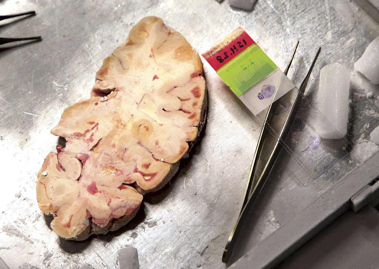 El trabajo en el Instituto Allen no es solo computacional. Empieza con cerebros reales, normalmente 'muertos', pero también cultivan células de cerebro vivo, aunque suene a cuento de terror… «No lo es en absoluto», nos explican. Cuando un neurocirujano interviene para tratar una epilepsia o un tumor cerebral, suele retirar porciones de tejido cortical. Normalmente se descarta, pero ahora se puede 'reciclar' y se cultiva en laboratorio.