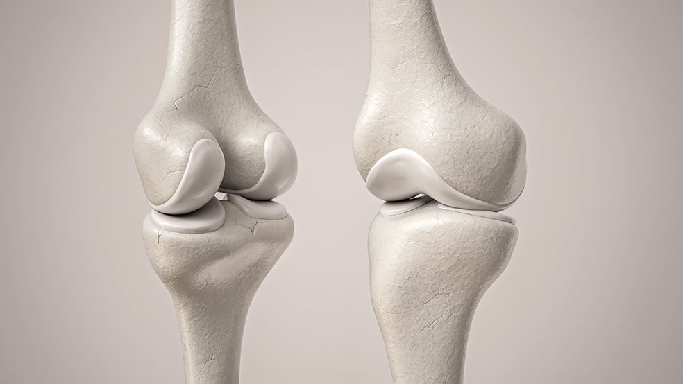 Como almohadillas blancas, los cartílagos recubren los extremos de cada hueso preparándolos para suavizar y amortiguar las zonas de unión y roce que se dan en las articulaciones. Si tocáramos ese tejido 'milagro', notaríamos que se trata de una sustancia viscoelástica gracias a que contiene colágeno y mucha agua (un 75 por ciento).