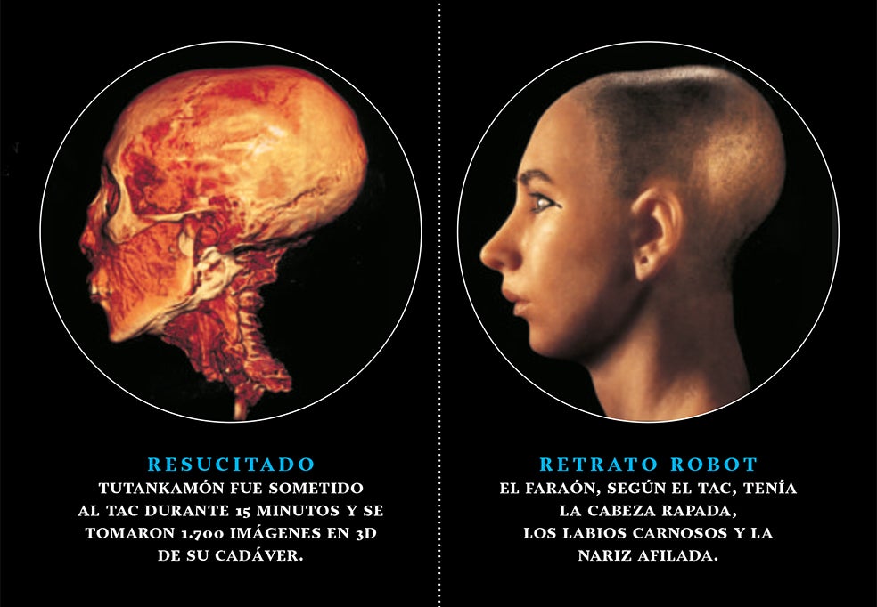 Las imágenes del TAC tomadas a Tutankamón permitieron descartar la teoría que atribuía su muerte a un golpe en la cabeza. La idea surgió en los 60, cuando su momia fue radiografiada y se observó un hueso suelto en el cráneo. Resultó ser una esquirla nasal que acabó ahí en la momificación. Por lo demás, no se halló evidencia alguna de asesinato.