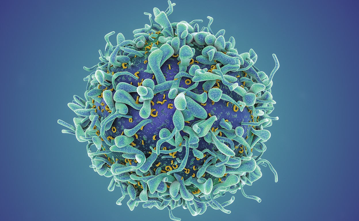 Dejar ‘amnésicas’ a las células atacantes: la gran apuesta contra el lupus