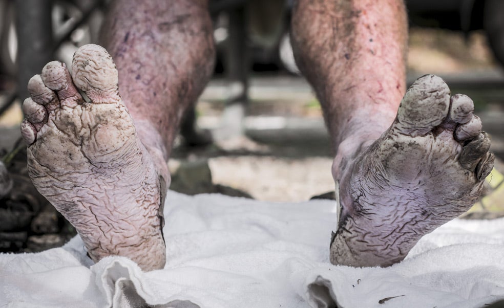Lo abrupto del terreno, la lluvia y los charcos que se deben atravesar destrozan los pies de los corredores, por muy sofisticado calzado que lleven. La mayoría se retira. Más arriba, en la imagen que abre este reportaje, el canadiense Gary Robbins se derrumba al llegar a la meta. Logró terminar, pero con seis segundos de retraso. Incapaz de moverse, lloraba consolado por su mujer. Durante el recorrido casi había perdido la razón.