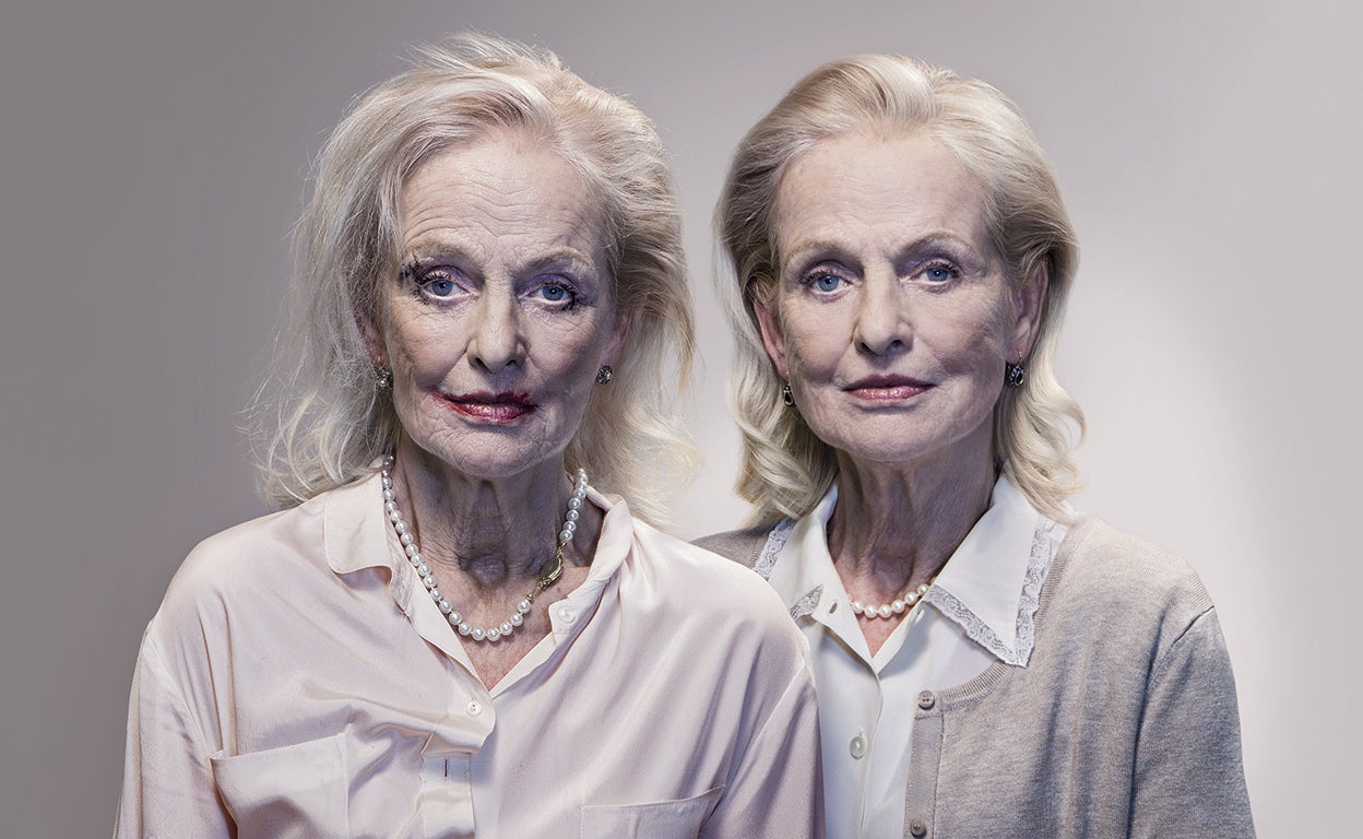 Párkinson, el misterio que todos quieren resolver (y que sigue sinuosos caminos)