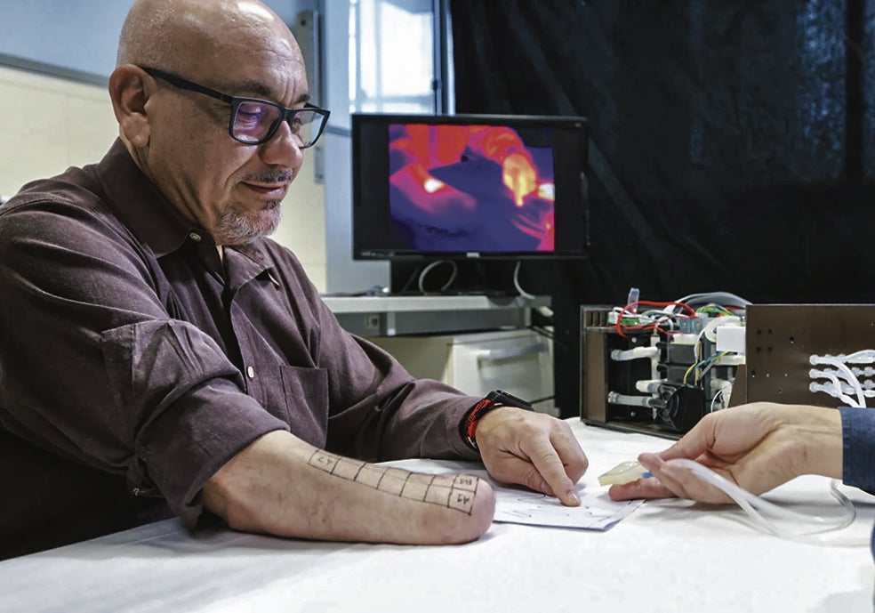 El año pasado se publicó en Science un avance clave en el campo de las prótesis. Con un dispositivo de 'tacto biónico' llamado Mini-Touch, los pacientes –como Fabrizio Fidati (en la foto)– pueden experimentar en su miembro 'fantasma' si un objeto está frío o caliente y distinguir si tocan cobre, plástico o vidrio.
