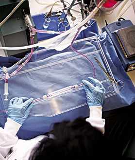 Imagen secundaria 2 - Las tres fases del método del doctor Seifalian. Alexander Seifalian ha creado un polímero biocompatible – un fluido plástico– que se solidifica al cambiar de temperatura. Con un molde, el polímero adopta la forma de los órganos que se busca reproducir; en este caso, una nariz. El fluido tiene poros microscópicos en los que serán luego ‘insertadas’ las células madre del paciente. Los poros del fluido se impregnan con las células madre en un biorreactor, un ambiente estéril que gira y proporciona riego y oxígeno a la mezcla. Las células madre extraídas de la médula ósea del paciente, se pueden convertir en cualquier tipo de célula del organismo y, por tanto, producir los mismos tejidos que se encuentran en el órgano que se pretende crear para implantarlo en el paciente.