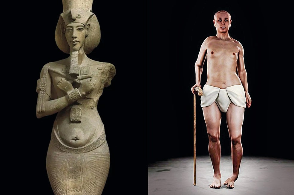 Las representaciones de Akenatón lo muestran con un cuerpo casi femenino, con caderas anchos, vientre caído, pechos grandes, brazos delgados y una barbilla prominente. Los expertos debaten si este aspecto singular indica alguna enfermedad congénita, como el síndrome de Marfan. Su hijo Tutankamón, cuyos restos se han podido analizar en detalle, mostraba signos de malformaciones óseas, que le causaban cojera.