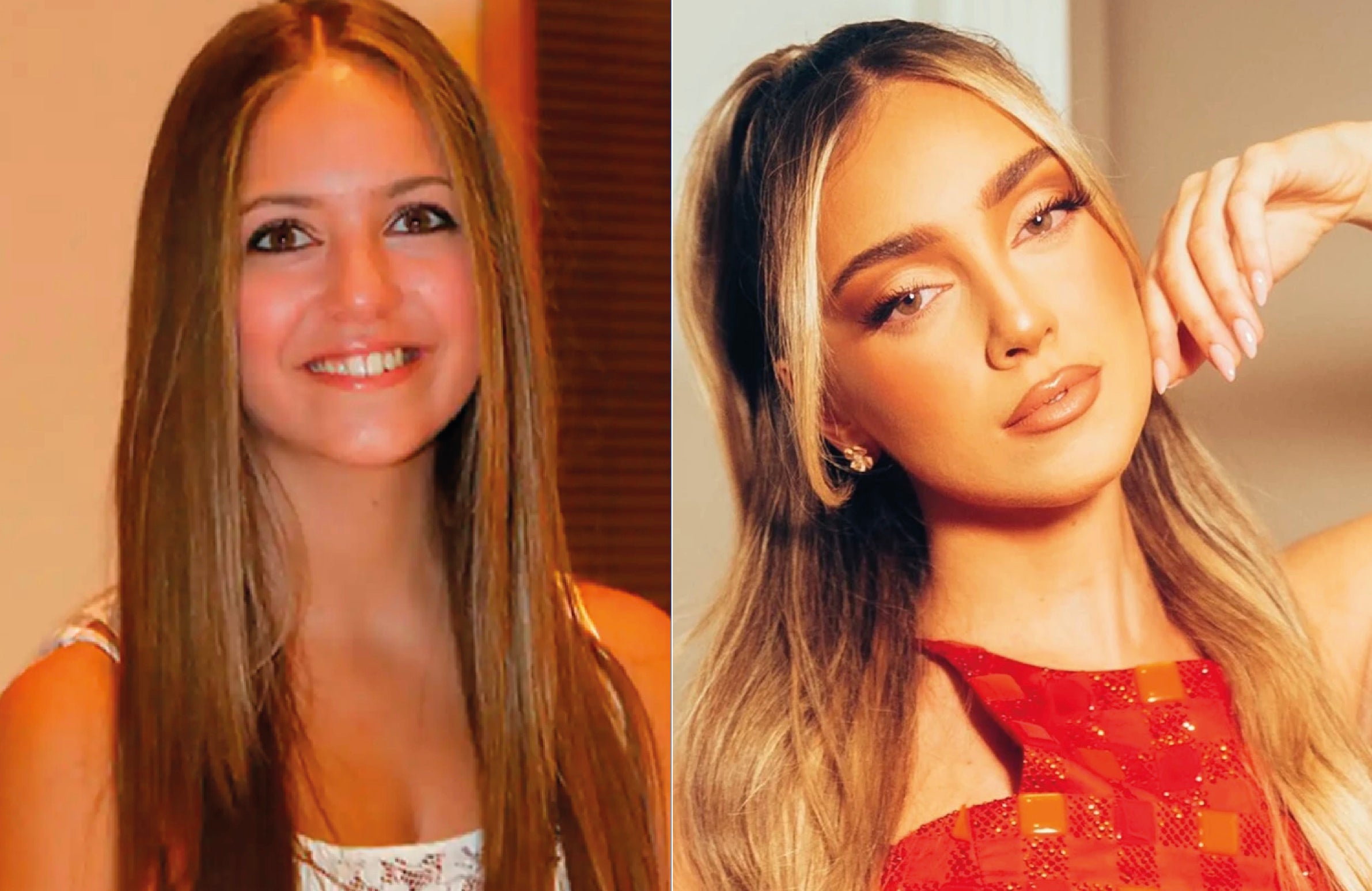 Desde sus primeras apariciones en cine y televisión, en películas como La piel que habito, de Almodóvar, o en programas como My Camp Rock 2 o la serie Supercharly, el cambio físico de Ana Mena ha sido muy evidente. Nariz más puntiaguda, labios más carnosos, pómulos flotantes... Alguien ha decidido cambiar.