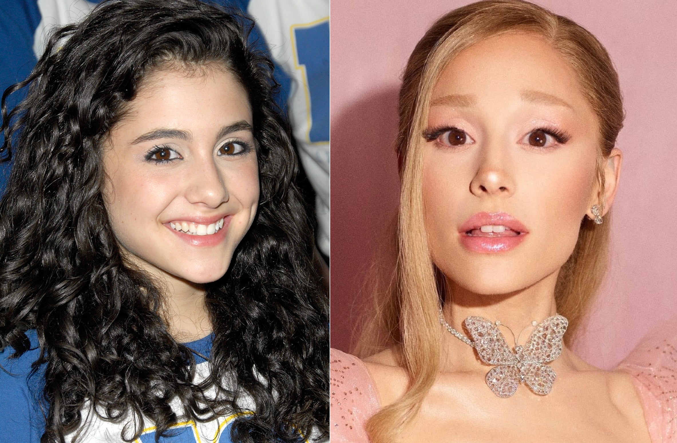 Los comentarios sobre su delgadez y su evolución facial han sido una constante en la carrera de Ariana Grande, la protagonista de Wicked. «Me puse un montón de relleno de labios a lo largo de los años. Dejé de hacerlo en 2018 porque simplemente sentía que me estaba escondiendo», aseguraba en 2023 a Vogue.