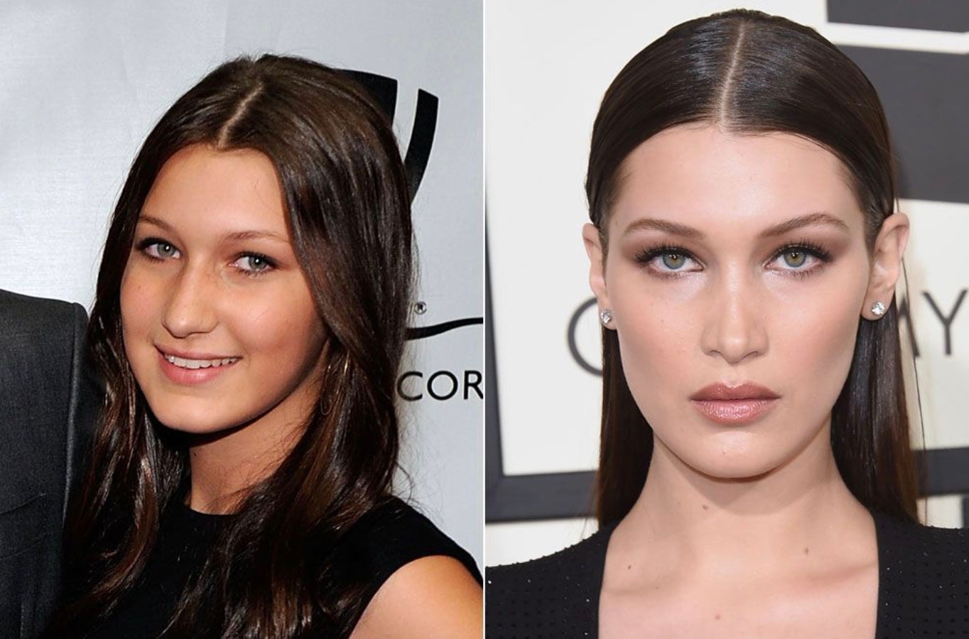 En 2022, la modelo Bella Hadid contaba a la revista Vogue que cuando tenía 14 años se hizo una rinoplastia de la que se arrepiente muchísimo. El motivo que la llevó a operarse fue el complejo de inferioridad que tenía respecto a su hermana Gigi. «Era la hermana fea», declaró. «Eso es lo que la gente decía de mí y, desafortunadamente, cuando te dicen esas cosas tantas veces, simplemente las crees».
