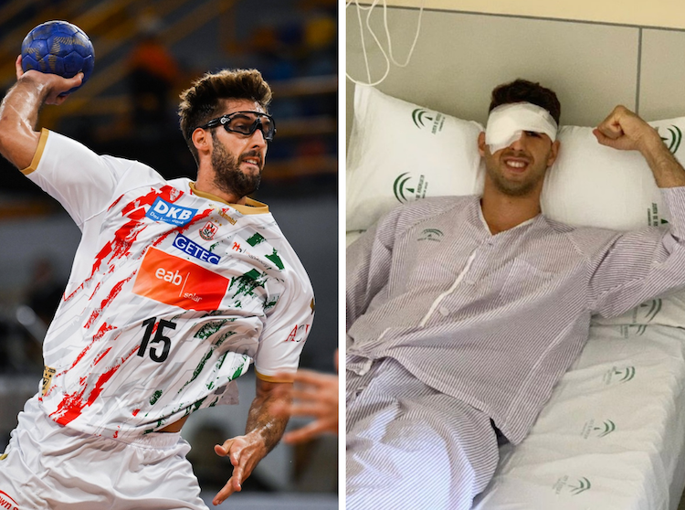 Antonio Serradilla tras la operación en la que se le extirpó el ojo derecho en 2021 en el Hospital Universitario de Sevilla. Al mirarse al espejo por primera vez después de la operación y ver su cara hinchada y la prótesis rosada, lloró. A la izquierda: jugando en la actualidad en el SC Magdeburg, de Alemania. No volver a jugar nunca fue una opción para él.