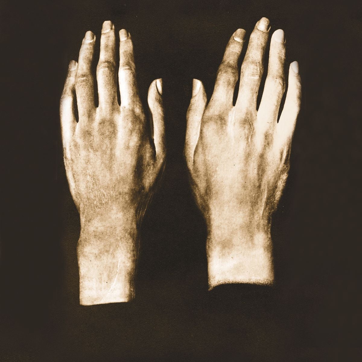 Beethoven murió en 1827, poco después de componer su novena sinfonía. También de sus manos se hicieron moldes de escayola.