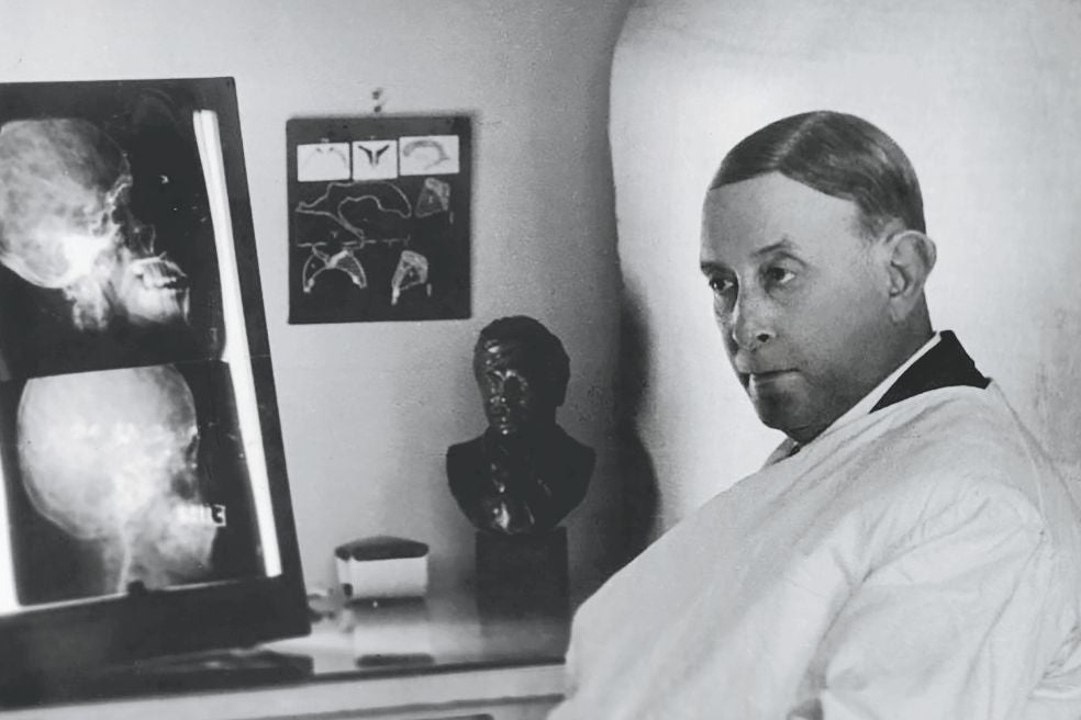 El neurocirujano por-tugués António Egas Moniz fue el inventor de la lobotomía, por lo que recibió el Premio Nobel en 1949. Diez años antes, un paciente psiquiátrico le disparó y lo dejó paralítico y en silla de ruedas hasta su muerte, en 1955.