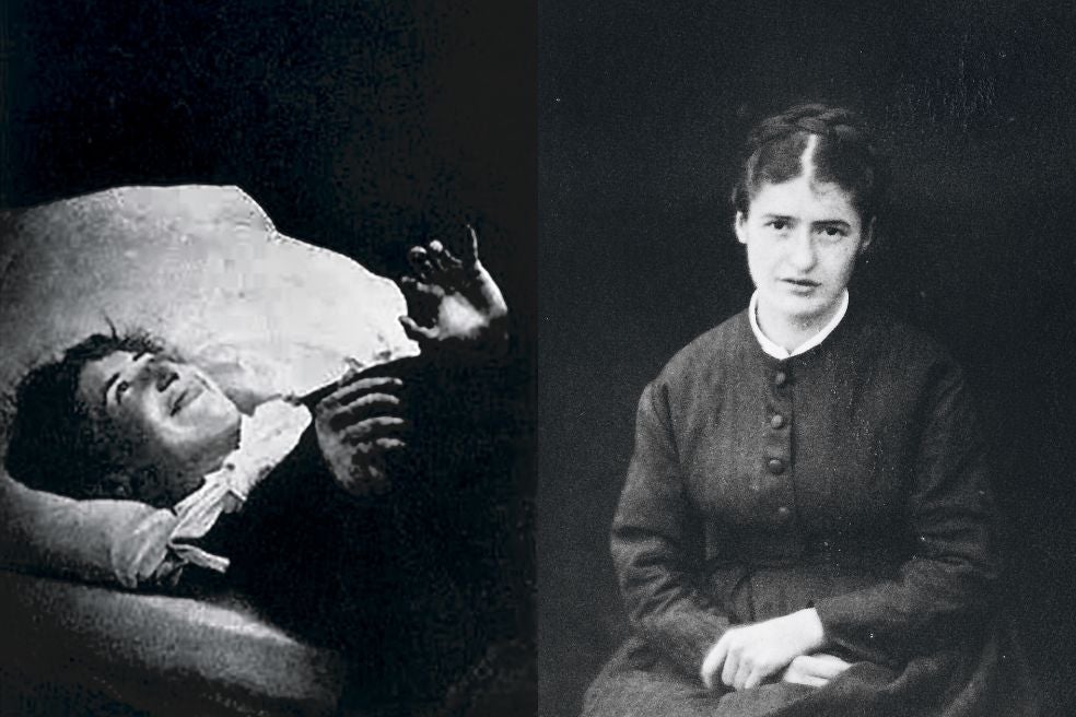 Las famosas «lecciones del martes» de Charcot en el hospital Salpêtrière eran auténticas representaciones clínicas, con público nacional e internacional. Uno de sus discípulos fue Freud, que convirtió la histeria en la puerta de entrada al inconsciente.